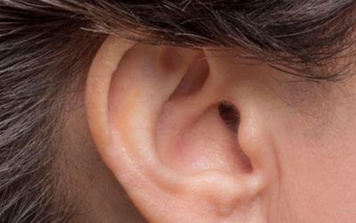 ¿Qué causa la hinchazón en el lóbulo de la oreja?