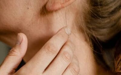 Tratamiento del acúfeno con terapia de aceptación y compromiso